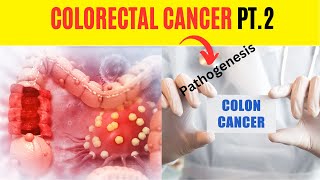 Discover the Surprising Pathophysiology of Colorectal Cancer!