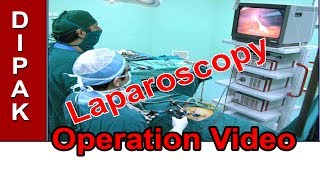 Laparoscopy Surgery - Alka Hospital