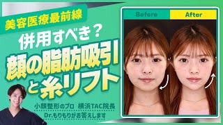 【プロが解説】《顔の脂肪吸引》と《糸リフト》は併用するべき？【美容ドクターもりもり】