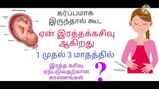 Bleeding during pregnancy in tamil/implementation bleeding in tamil