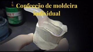 Moldeira individual para prótese total