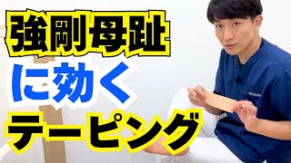 強剛母趾に効果的なテーピングの方法｜大阪市城東区の城東整骨院