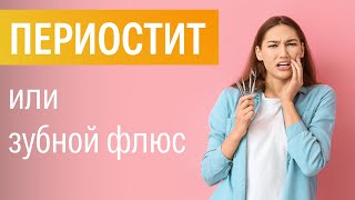 Периостит или флюс зуба. Что это и чем опасен? | стоматолог Игорь Збурин | Ранок надії