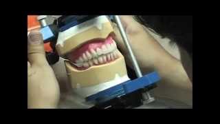 Complete Denture Setup
