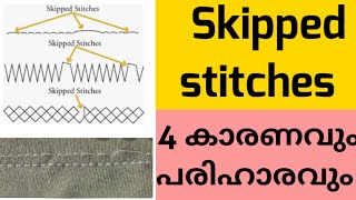 #easystitching  #malayalam  Skipped stitches - കാരണവും പരിഹാരവും