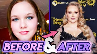 NikkieTutorials | Before and After Transformations | Her Cosmetic Surgery and Mo