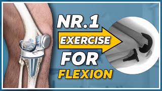The nr.1 exercise for gaining knee flexion after knee replacement