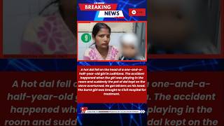 Innocent girl burnt with hot dal, dish flipped on her head while playing in the room | Colide News