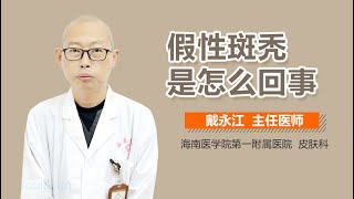 假性斑秃是怎么回事 有来医生