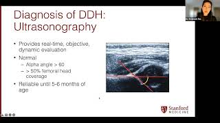 Pediatric Orthopedics and Sports Medicine Monthly Lecture Series: Common Pediatric Hip Conditions