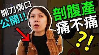 剖腹產 傷口 大公開 !?產婦 生產 過程 完全不痛?!老公 驚呼好神奇!?｜默森爸媽日記 ep6｜默森夫妻