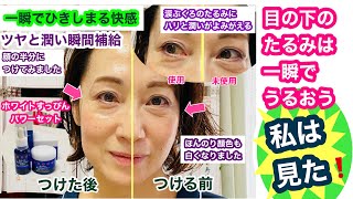 【使ってみた】ホワイトすっぴんパワーセット。一瞬で目元のたるみに変化が！