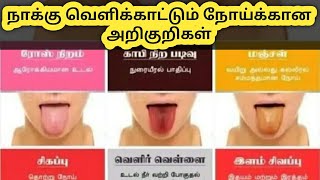 நாக்கு வெளிக்காட்டும் நோய்க்கான அறிகுறிகள் | How to find out disease through tongue in tamil