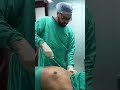 Gynecomastia Surgery in delhi  #shortvideo #shots #dezireclinicindia