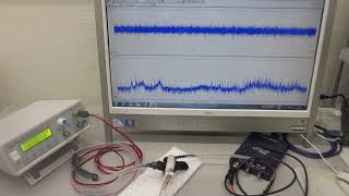 ６００ＭＨｚ以上の超音波伝搬状態を可能にする超音波発振制御プローブ（超音波システム研究所）