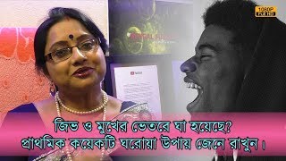 জিভ ও মুখের ভেতর ঘা হয়েছে? জ্বালা করছে? | এর প্রাথমিক কয়েকটি ঘরোয়া উপায় জেনে রাখুন। | EP 629