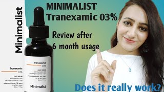 REVIEW- Minimalist Tranexamic 03% face serum for Melasma, Hyperpigmentation, Discoloration,Acne scar