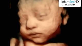 OMG BABY OPENS EYES IN ULTRASOUND HD LIVE 4D