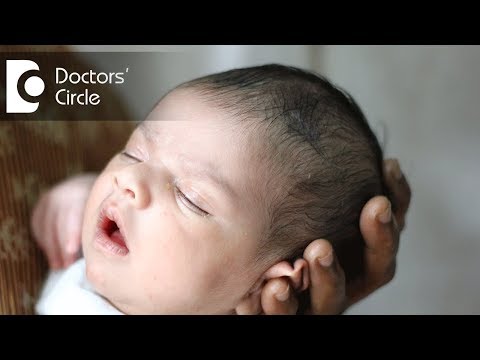 How to ensure right shape of head in newborns? - Dr. Varsha Saxena How to ensure right shape of head in newborns? - Dr. Varsha Saxena