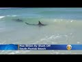 Man Bitten By Shark Off South Florida Beach