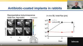 Combating AMR in Bacterial Infections and Investigating the Immune Response