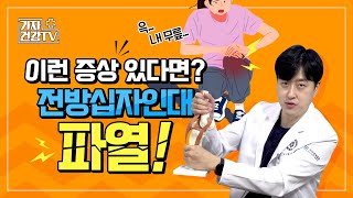 전방십자인대 파열 검사? 이 증상 있으면 전방십자인대 파열 의심!