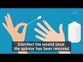 how to remove a splinter