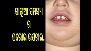 ଗାଲୁଆ ହେଲେ କଣ କରିବେ | galua hele kan kariba | Home remedies for Mumps