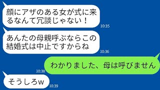 顔にやけどの跡がある母を見下し、結婚式への参加を拒否した婚約者の母。「参加したら式は中止だ」と言われ、最悪な義母の要求に従い式を中止にした結果。