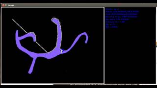 Bug 2 algorithm simulation : 1