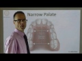 A Narrow Palate By Dr Mike Mew