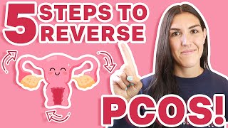 What Causes PCOS? How to REVERSE PCOS! (Yes, It Is Possible!)