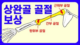 상완골 근위부, 간부, 원위부 골절 보상 범위는?