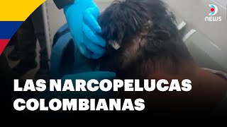 Colombia: Capturan a narco con droga oculta en peluca - DNews