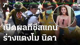 เปิดผลทีซีสแกนร่างแตงโมชันสูตรครั้งแรก | 16-03-65 | ข่าวเที่ยงไทยรัฐ