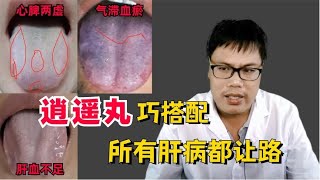 逍遥丸巧搭配，不止疏肝解郁，还有三大妙用！   【舌诊案例分析】