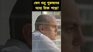 Why do boys go bald? কেন ছেলেদের টাক পড়ে? #shorts #facts