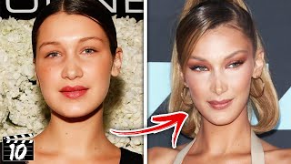 Top 10 Celebrities Accused Of Lying About Plastic Surgery