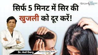 सिर्फ 5 मिनट में सिर की खुजली और रूखेपन को दूर करें | Home Remedies for Dry and Itchy Scalp