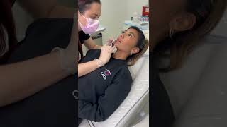 Inside Look at Lip Injections 💋   #lipfiller  #lipinjections  #lipplumper  #plumplips #fulllips