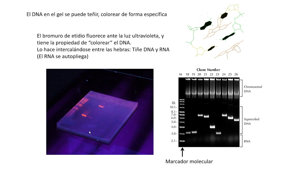 4 Electroforesis En Geles De Agarosa - YouTube