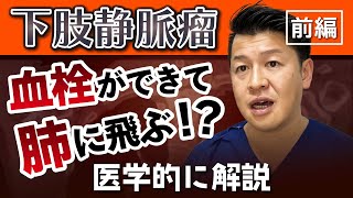 下肢静脈瘤と血栓：肺に飛ぶ危険性とは？【医学解説】（前編）