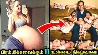 உலகில் மிக வினோதமாக நடந்த 11 பிரசவங்கள்! | Most Bizarre Pregnancy Cases | Tamil Ultimate