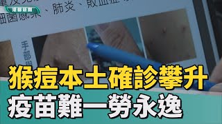 猴痘疫情 | 猴痘本土確診攀升 親密接觸傳染疫調難