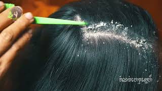 She scratch dandruff look so interested 2176