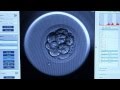 Embryoscope™ - CREATE Fertility