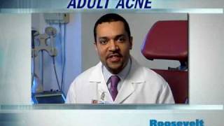 Adult acne treatment. Dr. Andrew Alexis, dermatologist at Mount Sinai West in New York City