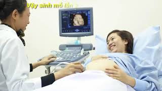 Sinh mổ lần 2 nên nhập viện khi nào Kinh nghiệm sinh mổ lần 2