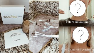 Does that INSTAGRAM TEETH WHITNER actually work? | NOVASHINE