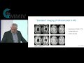 mmiv conference 2020 kjell morten myhr neuro sysmed – and the role of imaging – what do we need